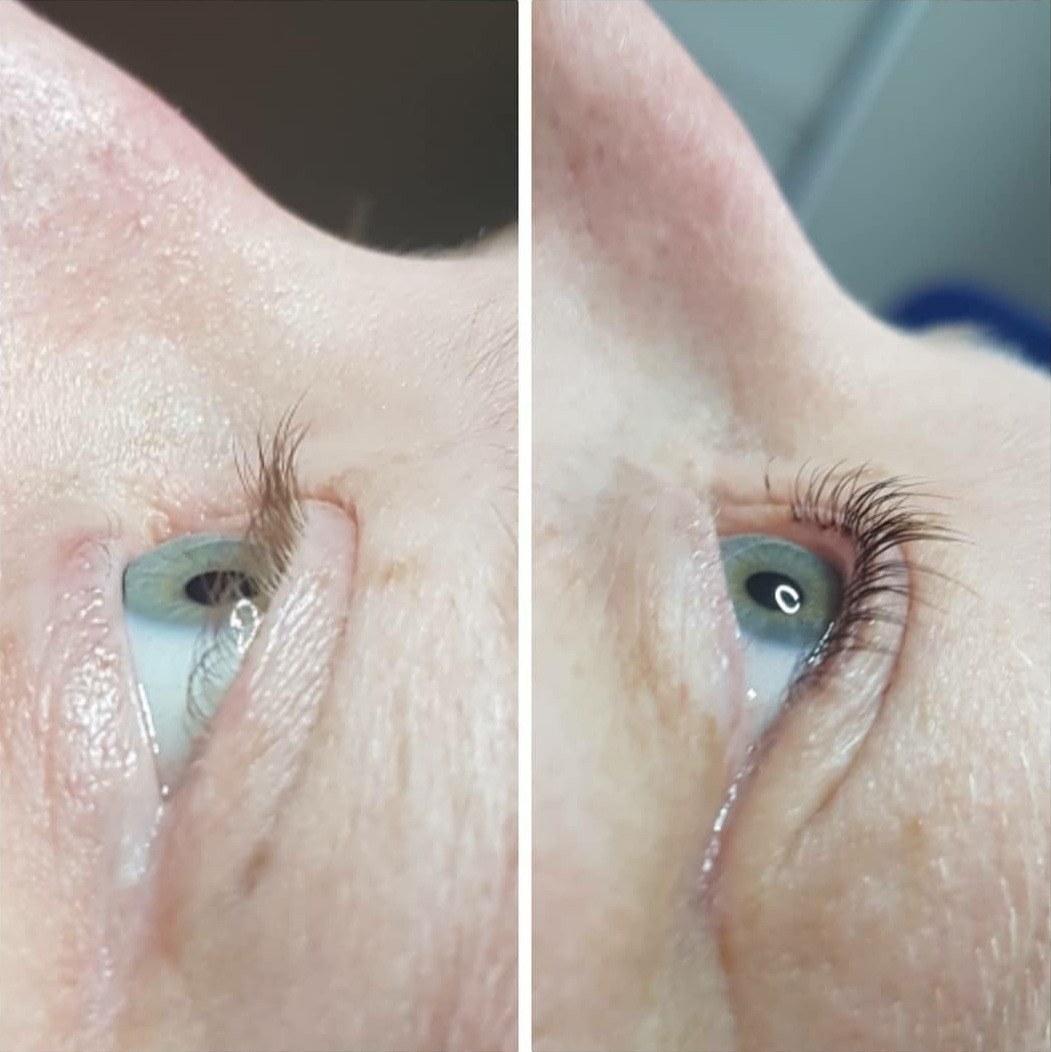 Wimperlifting voor en na: links de wimpers ervoor, rechts erna